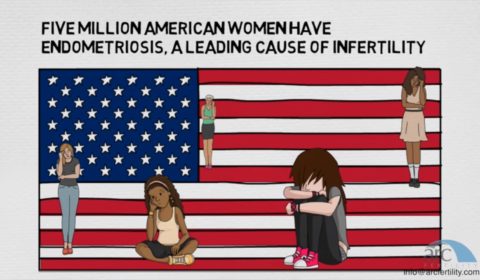Endometriosis
