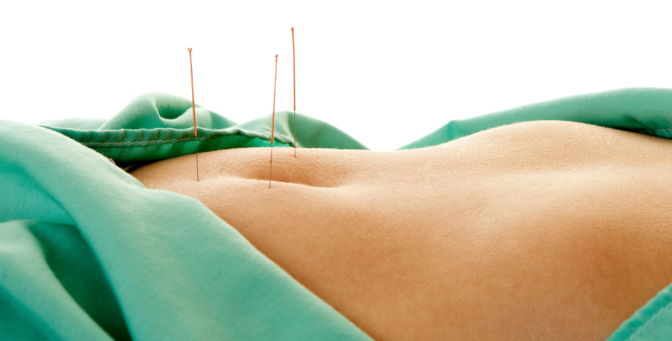 Acupuncture proponents have recommended it for a variety of medical conditions that affect fertility.