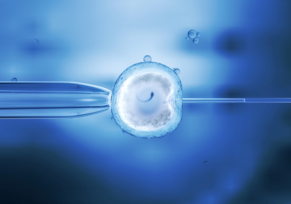 IVF with ICSI