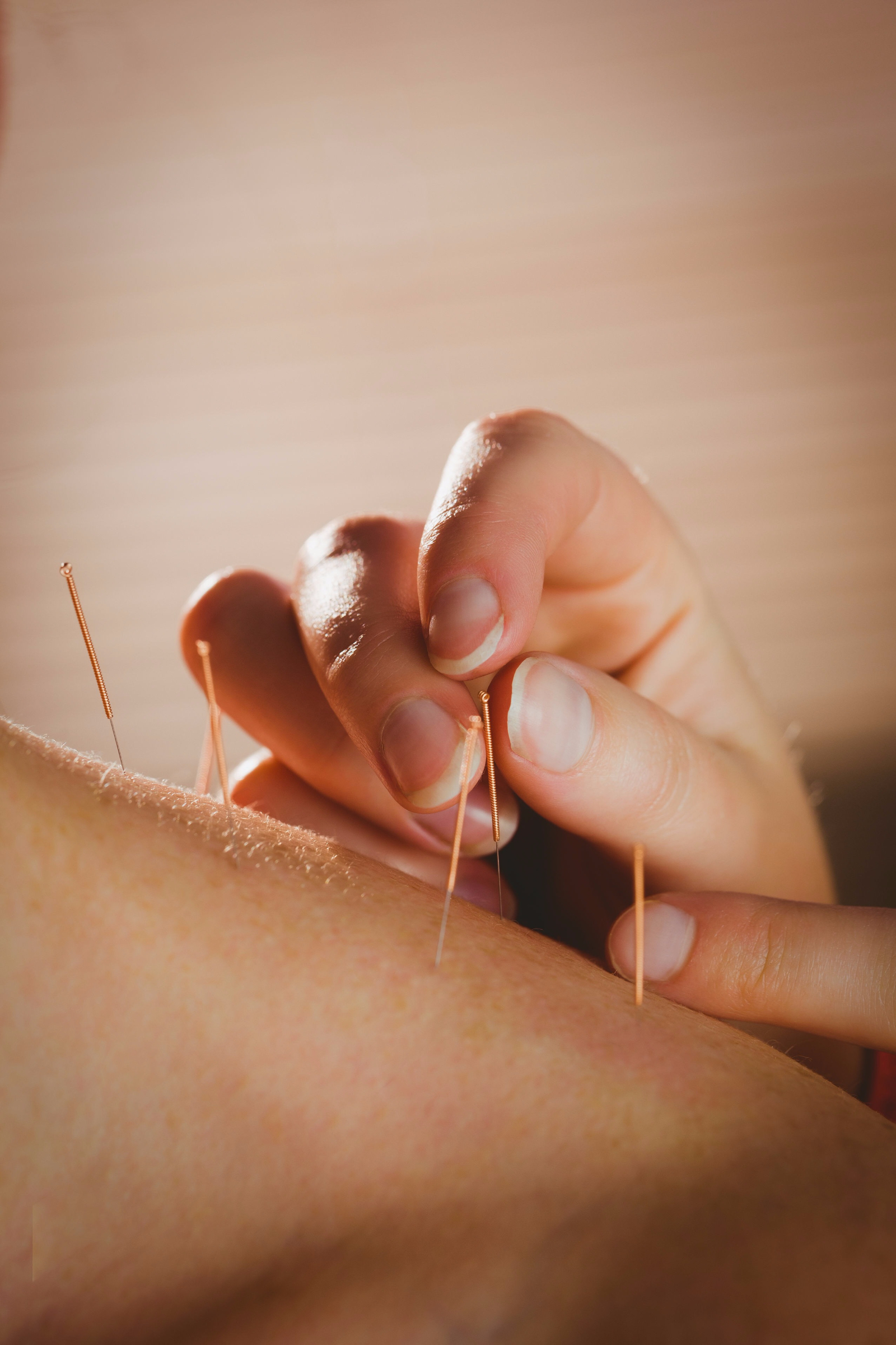 acupuncture for natural fertility