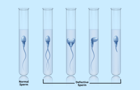 semen analysis