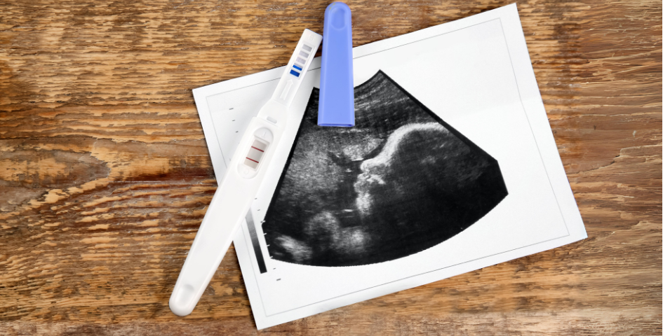 Positive pregnancy test next to a sonogram