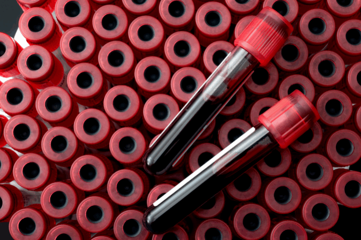 Two different blood tests, but both AMH and FSH can give a lot of information for a woman's fertility.
