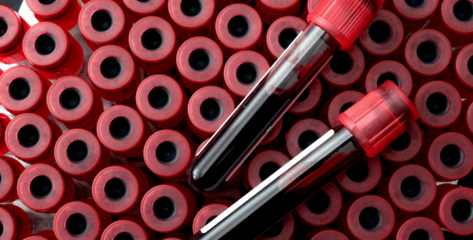Two different blood tests, but both AMH and FSH can give a lot of information for a woman's fertility.